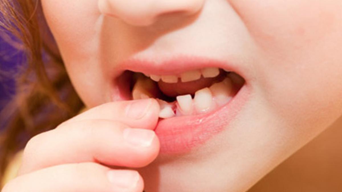 Mơ thấy răng rụng là gì 2