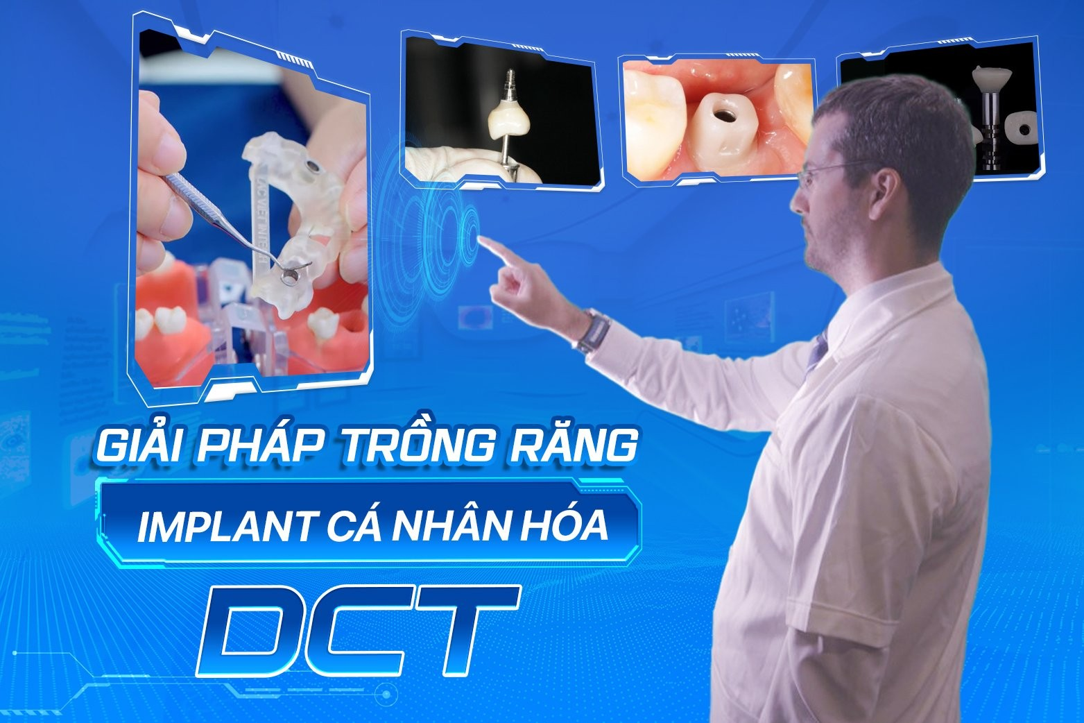 Trồng răng cá nhân hóa DCT là giải pháp phục hình răng tiên tiến nhất hiện nay